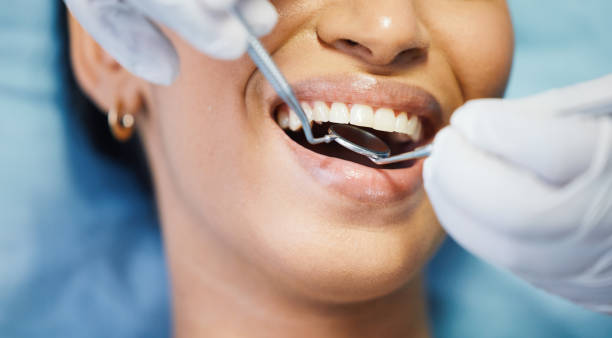 Best Knocked-Out Tooth Emergency  in Nevada, MO